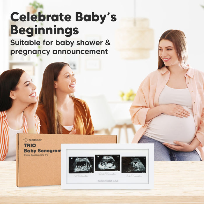 Celebrate Baby’s Beginnings, perfect for baby showers and pregnancy announcements.